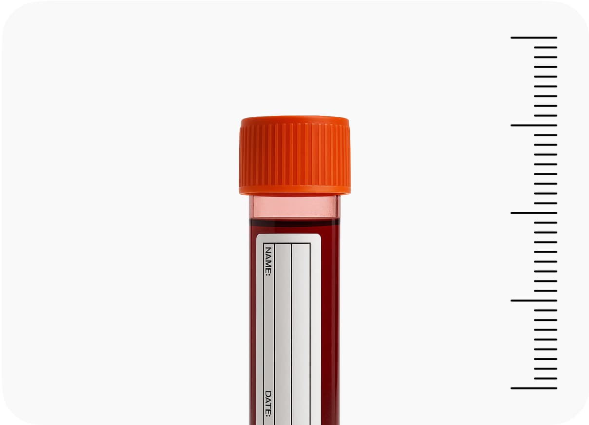 Schedule<br />your test